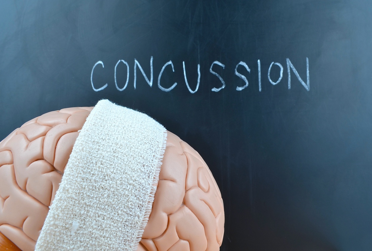Post-concussion syndrome assessment