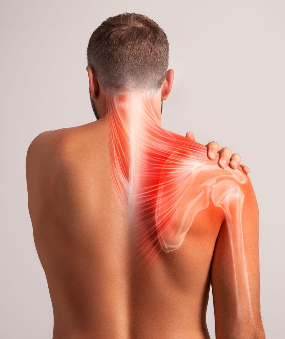 Neck and Shoulder Pain Complexity